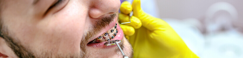 Orthodontie adulte : indications, prix, remboursement